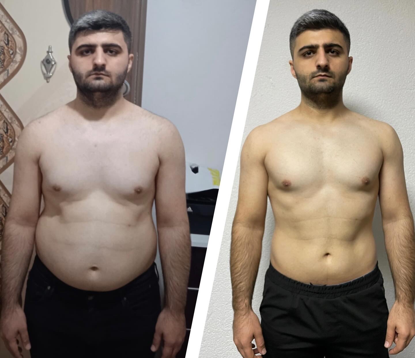 Before After Transformation 5